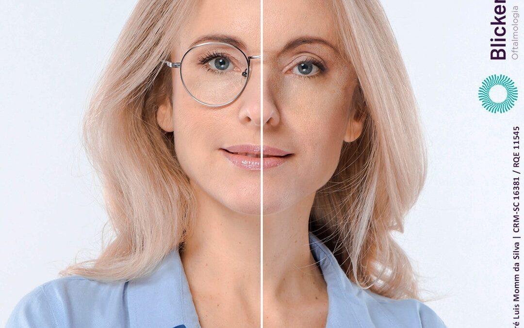 Você sabia que é possível fazer uma cirurgia para não precisar mais usar óculos?