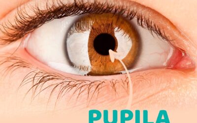 PUPILA o que é?