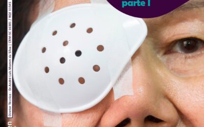 Cuidados após cirurgia de catarata – PARTE I