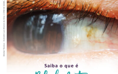 Saiba o que é BLEFARITE!⠀