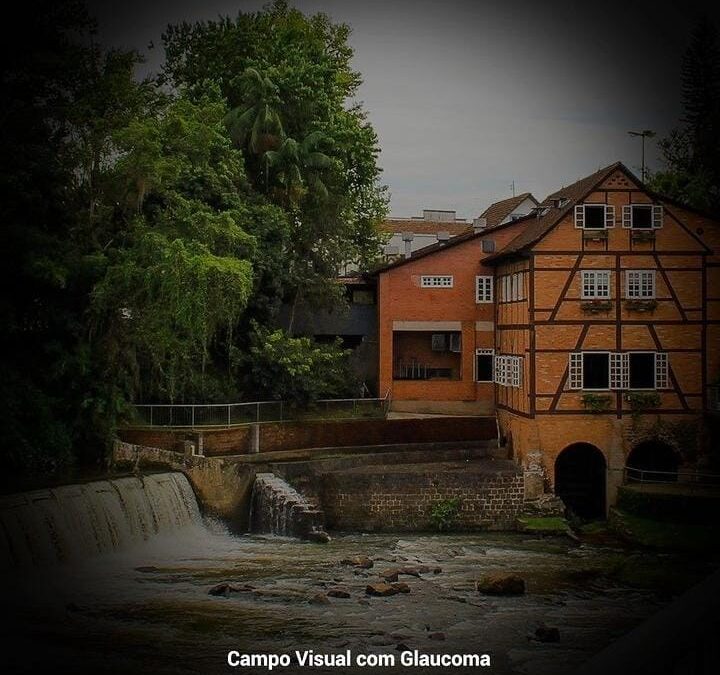 Como é um campo visual comprometido pelo GLAUCOMA?